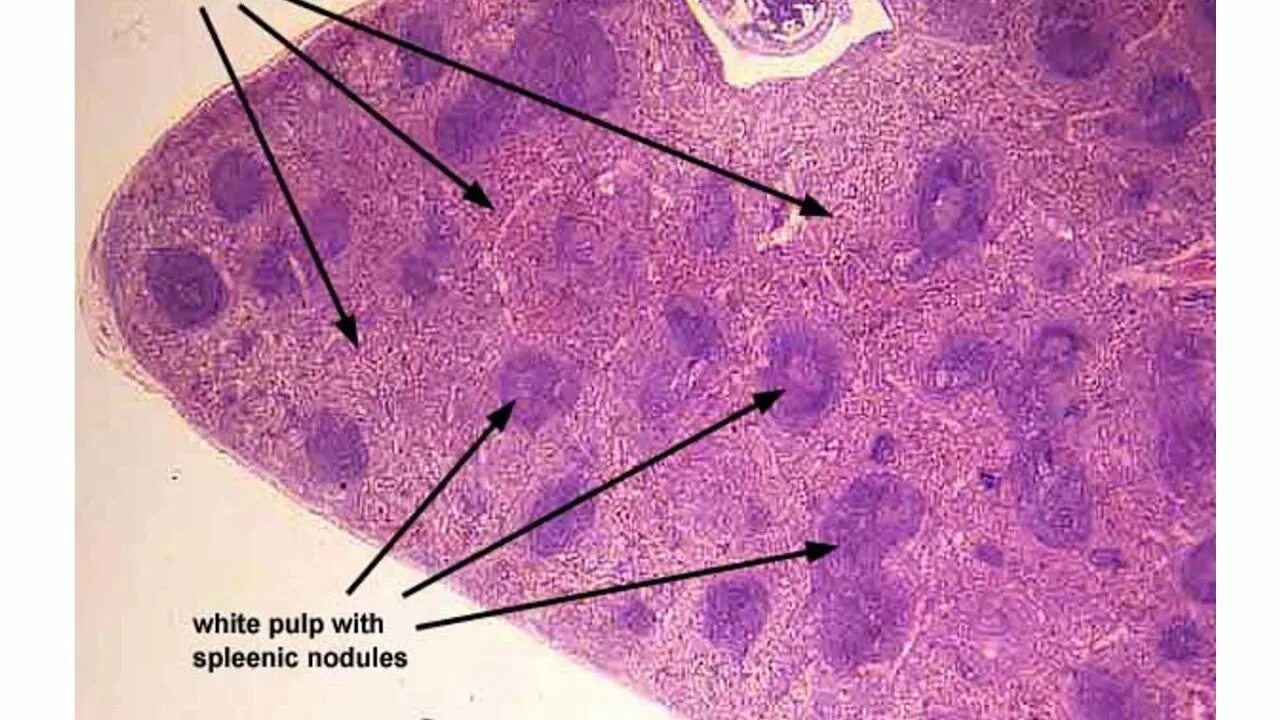 Ткань селезенки. Строение селезенки гистология. Селезенка гистология препарат. Белая пульпа селезенки гистология. Селезенка микропрепарат гистология.