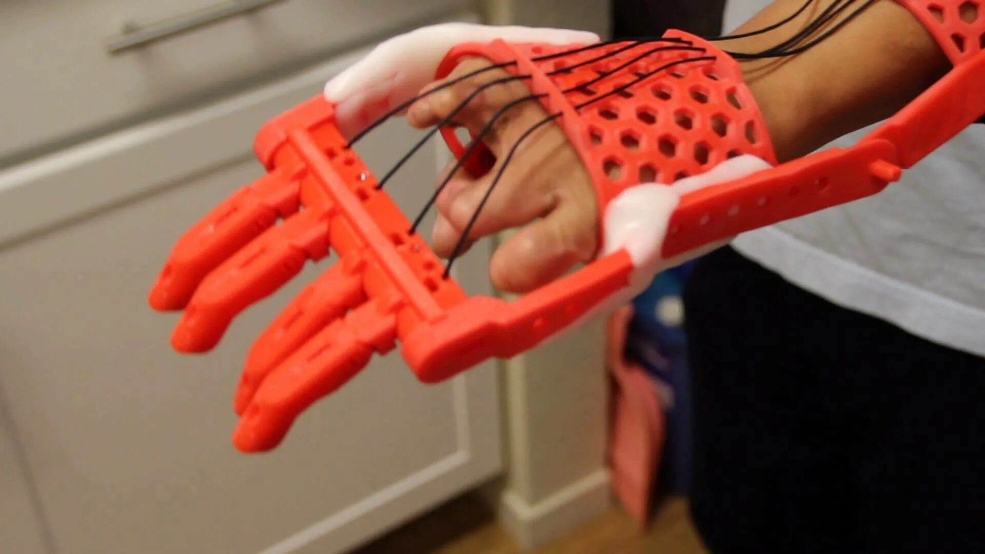 Длинные тонкие пальцы. Длинные пальцы. Дистракция пальца на руке. Укрепить кисти рук и запястья. Синдром марфана (арахнодактилия).