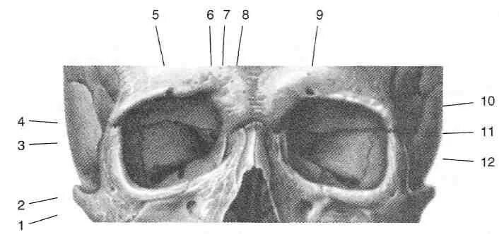 Левой глазницы. Костные стенки глазницы анатомия. Глазница черепа анатомия. Верхняя глазничная щель анатомия. Медиальная стенка орбиты анатомия.