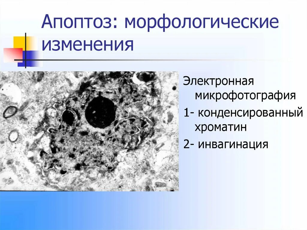 Морфологические изменения клеток. Апоптоз микрофотография. Апоптоз лимфоцитов микрофотографии. Апоптоз клетки микрофотографии.