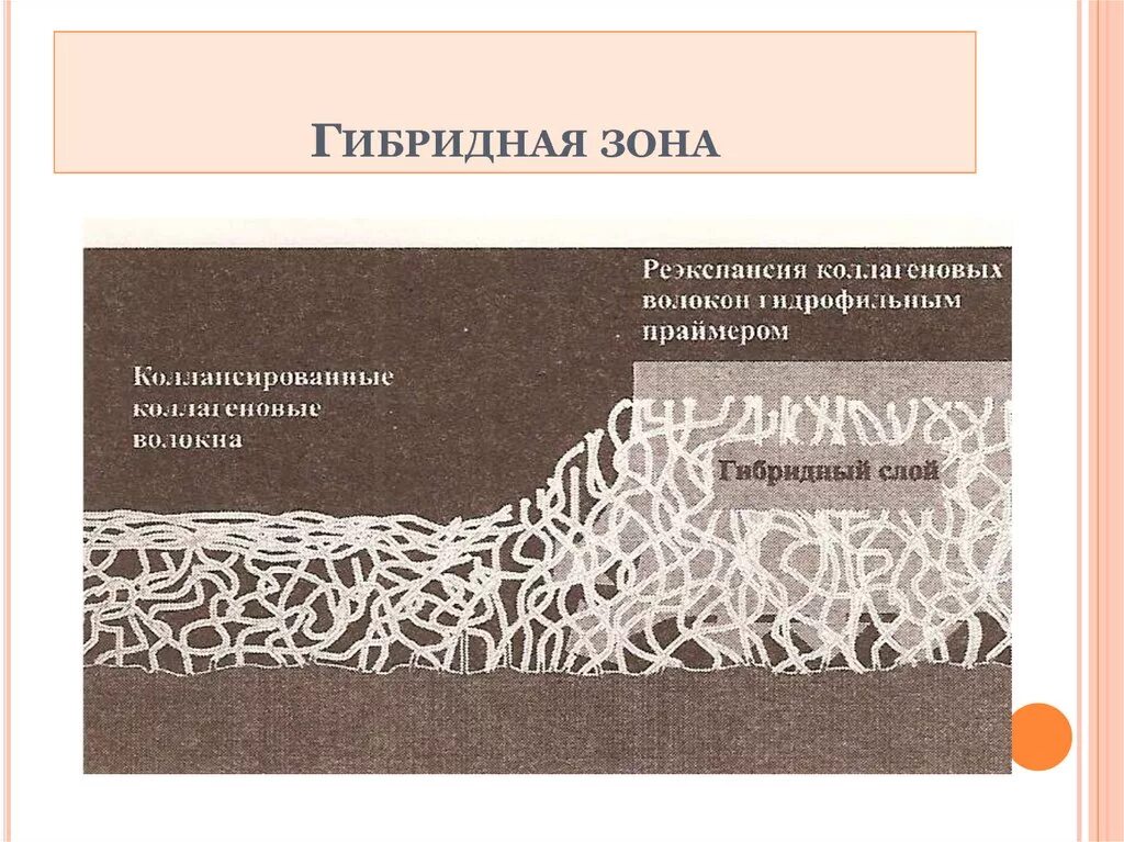 Гибридная зона. Смазанный слой гибридный слой. Гибридный слой в стоматологии. Гибридная зона. Peripatric speciation.