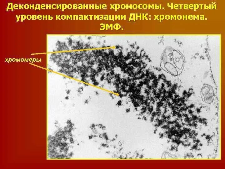 Деконденсированные хромосомы. Деконденсированное состояние хроматина это. Зоны неконденсироуоного хромотина. Сильно деконденсированный хроматин это. Хромосомы речного рака