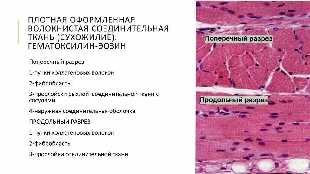 Соединительную ткань сосуды. Плотная волокнистая соединительная ткань гистология. плотная неоформленная соединительная ткань препарат гистология. плотная соединительная ткань гистология препарат. плотная волокнистая соединительная ткань сухожилия препарат.
