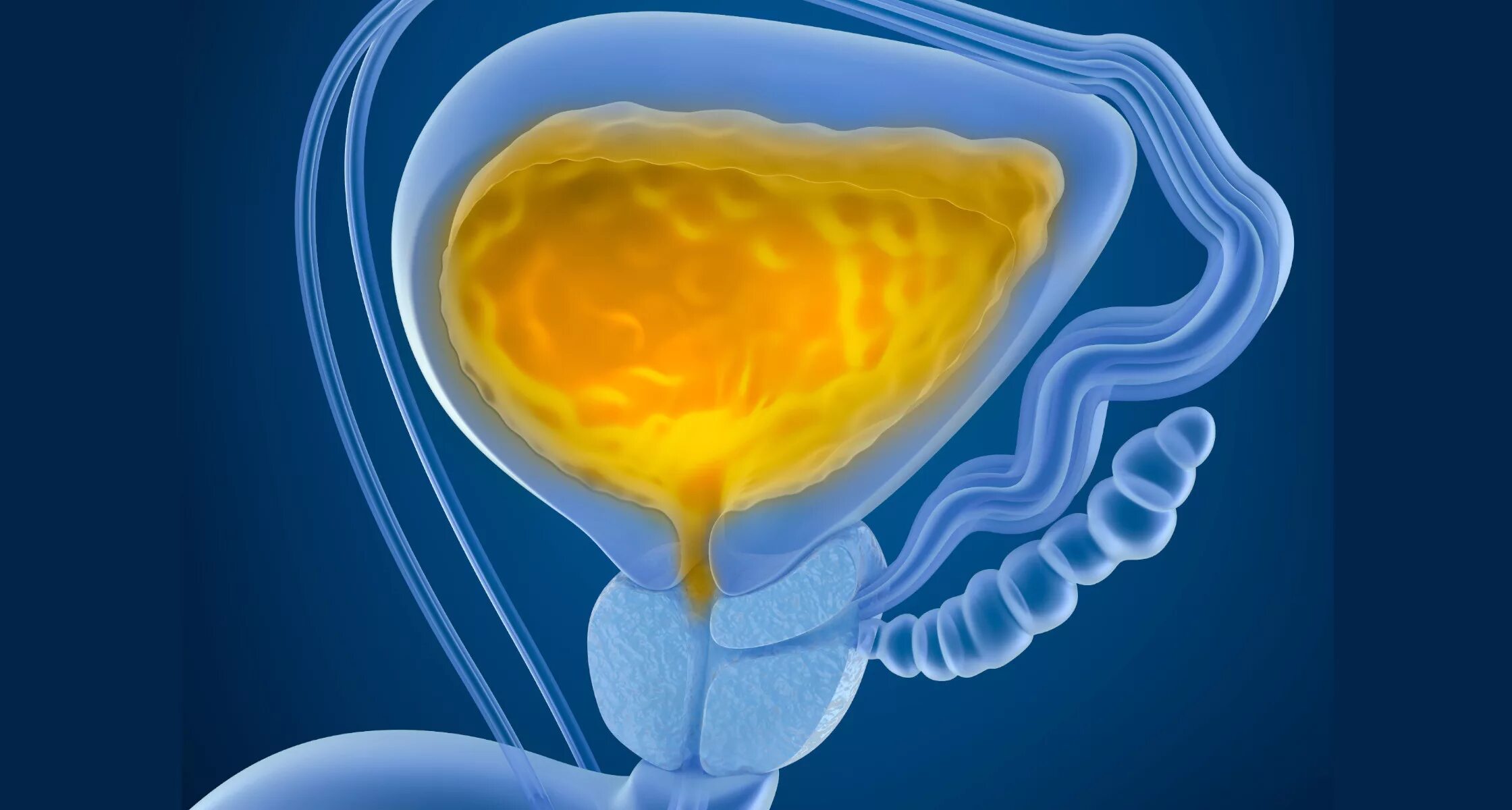 Мочевой пузырь мочеиспускание. Острая задержка мочеиспускания. Мочевой пузырь картинка. Урология мочевой пузырь. Высокое давление мочеиспускание