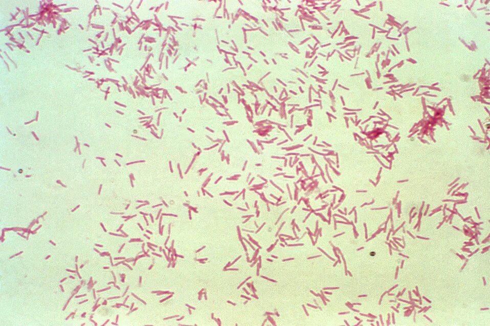 Haemophilus influenzae микробиология. Бактероидес фрагилис возбудитель. Prevotella intermedia морфология. Пептококки нигер. Bacteroides porphyromonas prevotella.