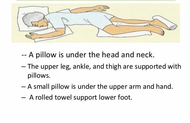 Ending position. Pcnl prone position на операцион стола. prone как запомнить. prone position действие. acne prone position.
