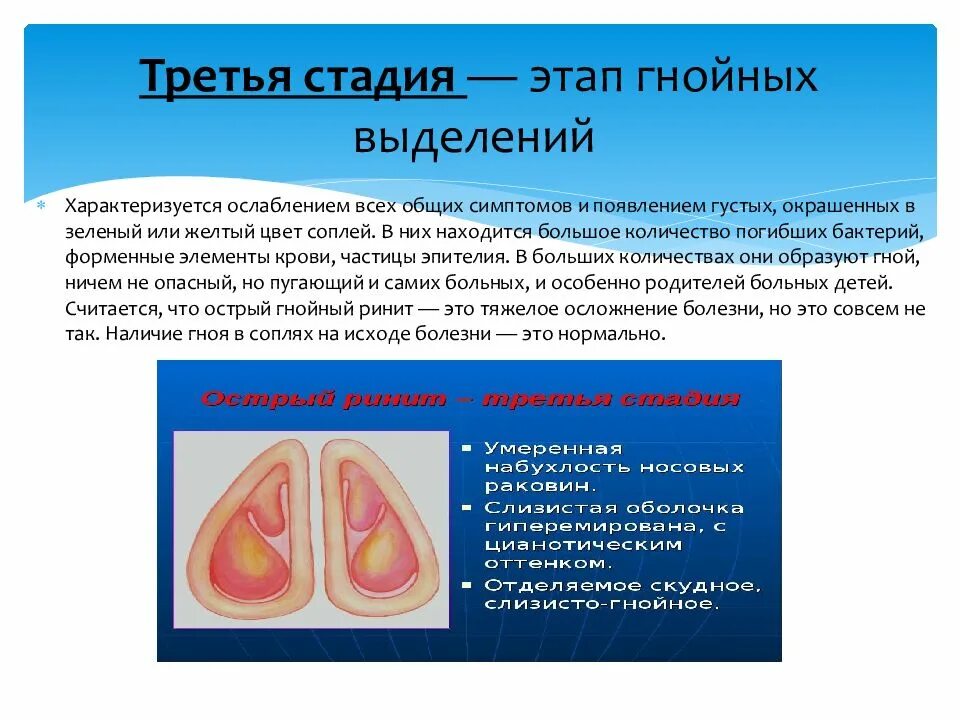 Гнойную степень. Острый и хронический ринит презентация. 3 Стадии острого ринита.