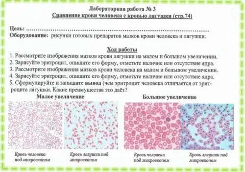 Исследование крови лягушки какая биологическая наука. Сравнение крови человека с кровью лягушки лабораторная. Лабораторная работа по биологии 8 класс сравнение крови. Лабораторная работа сравнение крови человека с кровью лягушки. Сравнение крови человека с кровью лягушки лабораторная работа 5.