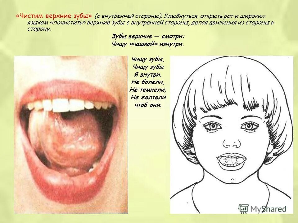 чашечка логопедическое упражнение. артикуляционная гимнастика блинчик рот. упражнения для рта. как сделать рот шире. артикуляционная гимнастика для детей.