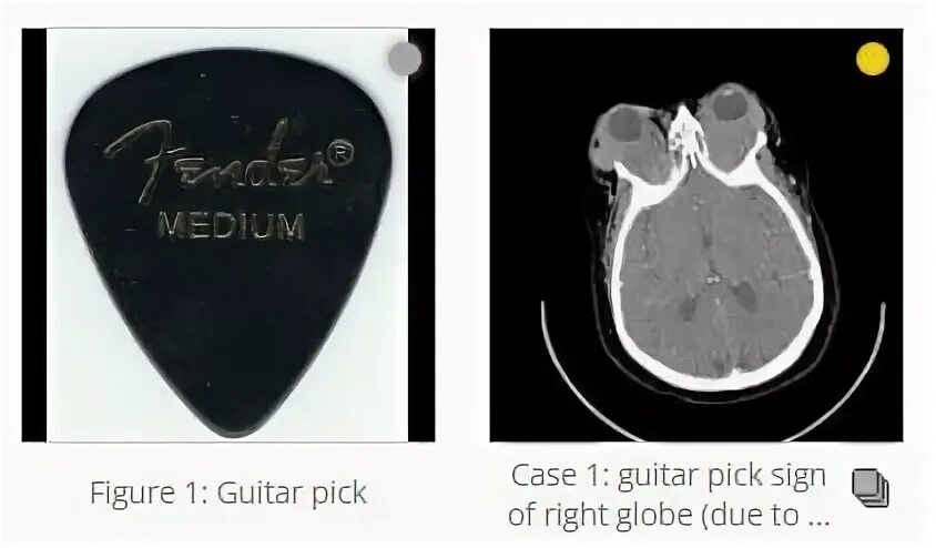 Picked sang