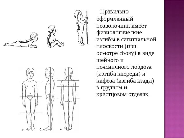 Изгиб кпереди. Сагиттальная плоскость позвоночника. Упражнения при нарушениях осанки в сагиттальной плоскости. Изгибы позвоночника в сагиттальной плоскости. Искривление позвоночника в сагиттальной плоскости.