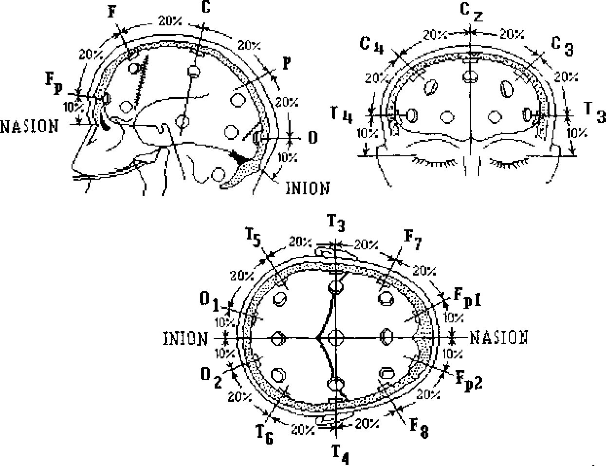 Ээг 10 10. Схема расположения электродов при ЭЭГ 10-20. Схема ЭЭГ 10-20. Международная схема электродов ЭЭГ 10-20. Схема наложения электродов ЭЭГ.