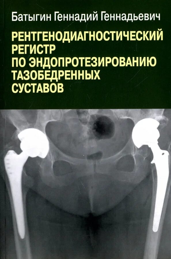 Горяев тазобедренного сустава. Тазобедренный сустав. тазобедренный сустав книга. препараты при коксартрозе тазобедренного сустава 2.