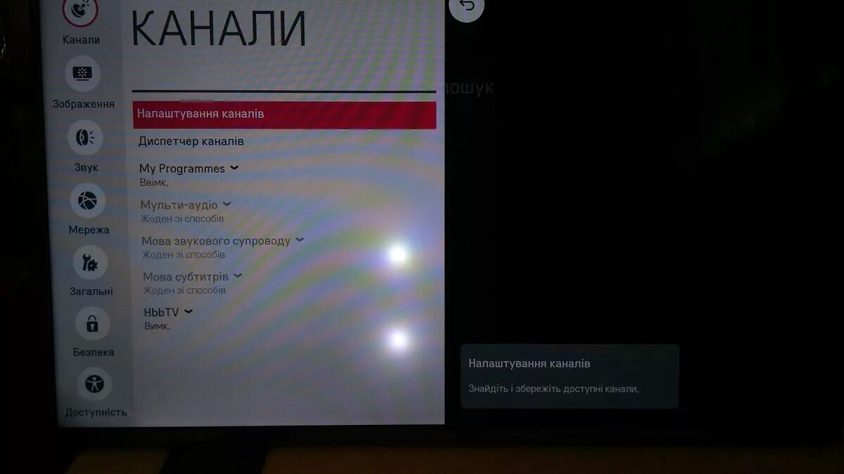 Почему на экране точка. Белые пятна на экране телевизора LG. На телевизоре LG появились белые пятна на экране. Белые пятна на телевизоре LG. Белые пятка LG телевизора пятна.