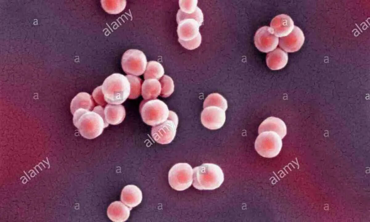 Гемолитический стафилококк прыщи. Staphylococcus epidermidis акне. Кожный золотистый стафилококк. Золотистый стафилококк на коже. Staphylococcus aureus 5