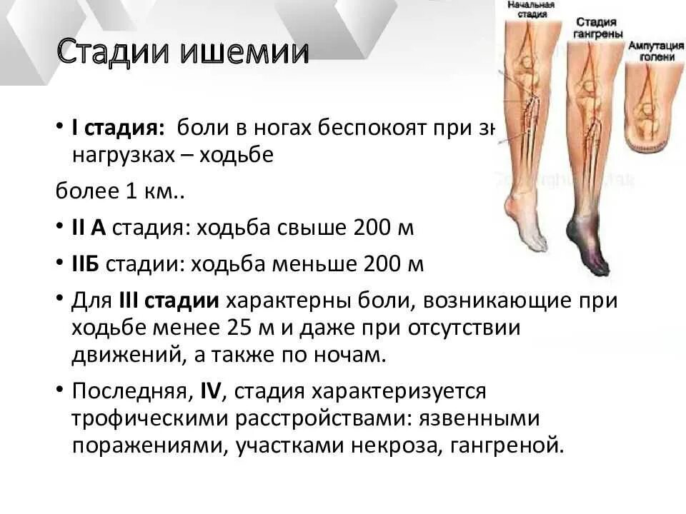 Стадии хронической ишемии нижних конечностей. Гангрена стопы 1 степени. Стадии гангрены конечности. Ампутация конечностей мкб