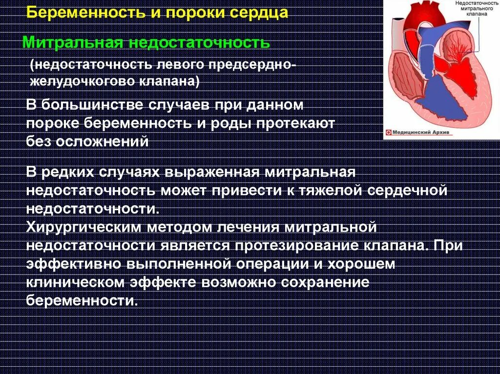 Пороки сердца при беременности. Принципы ведения беременности при пороках сердца. Недостаточность митрального клапана факторы риска. Сердечная недостаточность митрального клапана