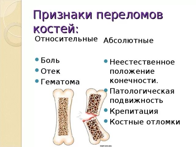 Для перелома характерно тест. Основным симптомом перелома трубчатых костей является:. Основной симптом перелома трубчатых костей. Перелом длинных трубчатых костей симптомы. Перелом трубчатых костей симптомы.