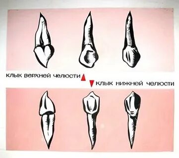 Верхний зуб клык