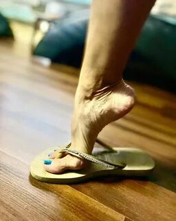 High arched feet