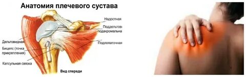 Невралгия рука плечо