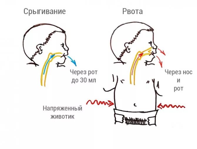 Что делать если через. Профилактика срыгивания.