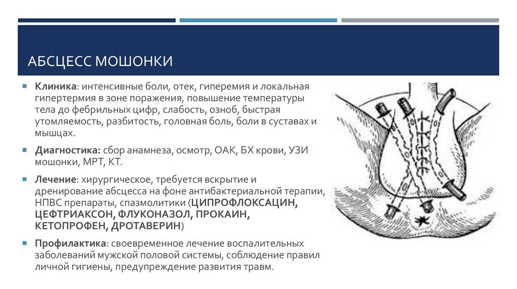 Вскрытие и дренирование абсцесса. Вскрытие и дренирование флегмоны (абсцесса). У мужчины болит правое яйцо причины