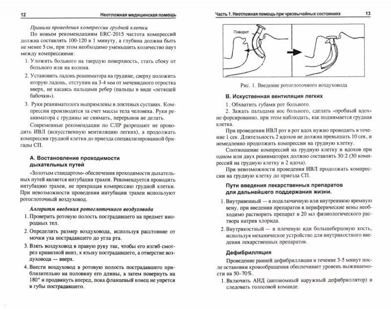 Воздуховод алгоритм. Техника введения воздуховода. введение орофарингеального воздуховода. введение орофарингеального воздуховода алгоритм.