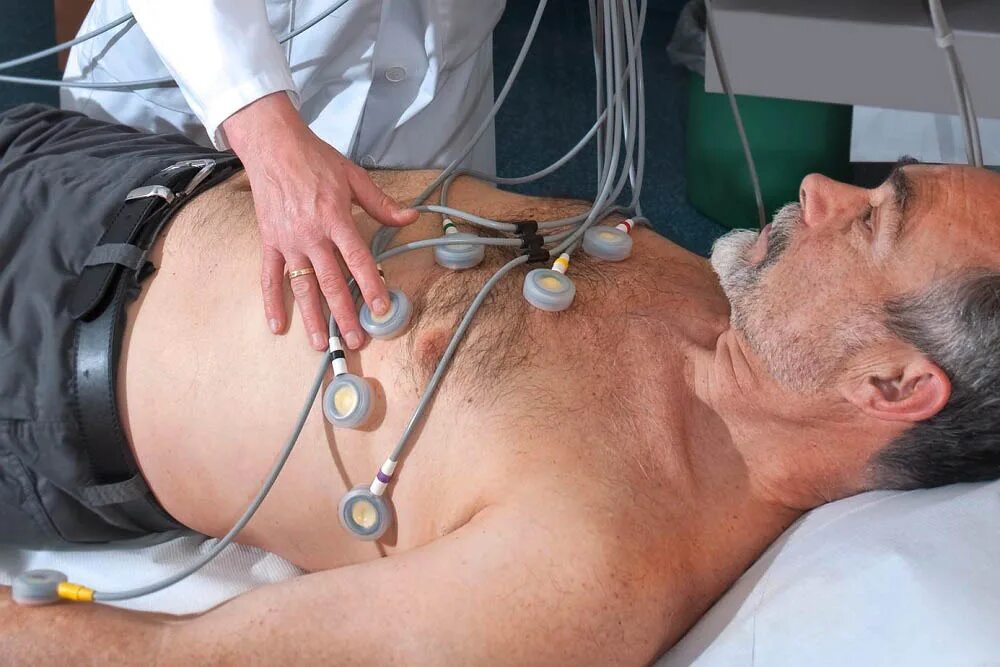 Ишемия у мужчин. ЭКГ сердца. Электрокардиограмма пациента. Электрокардиография сердца.