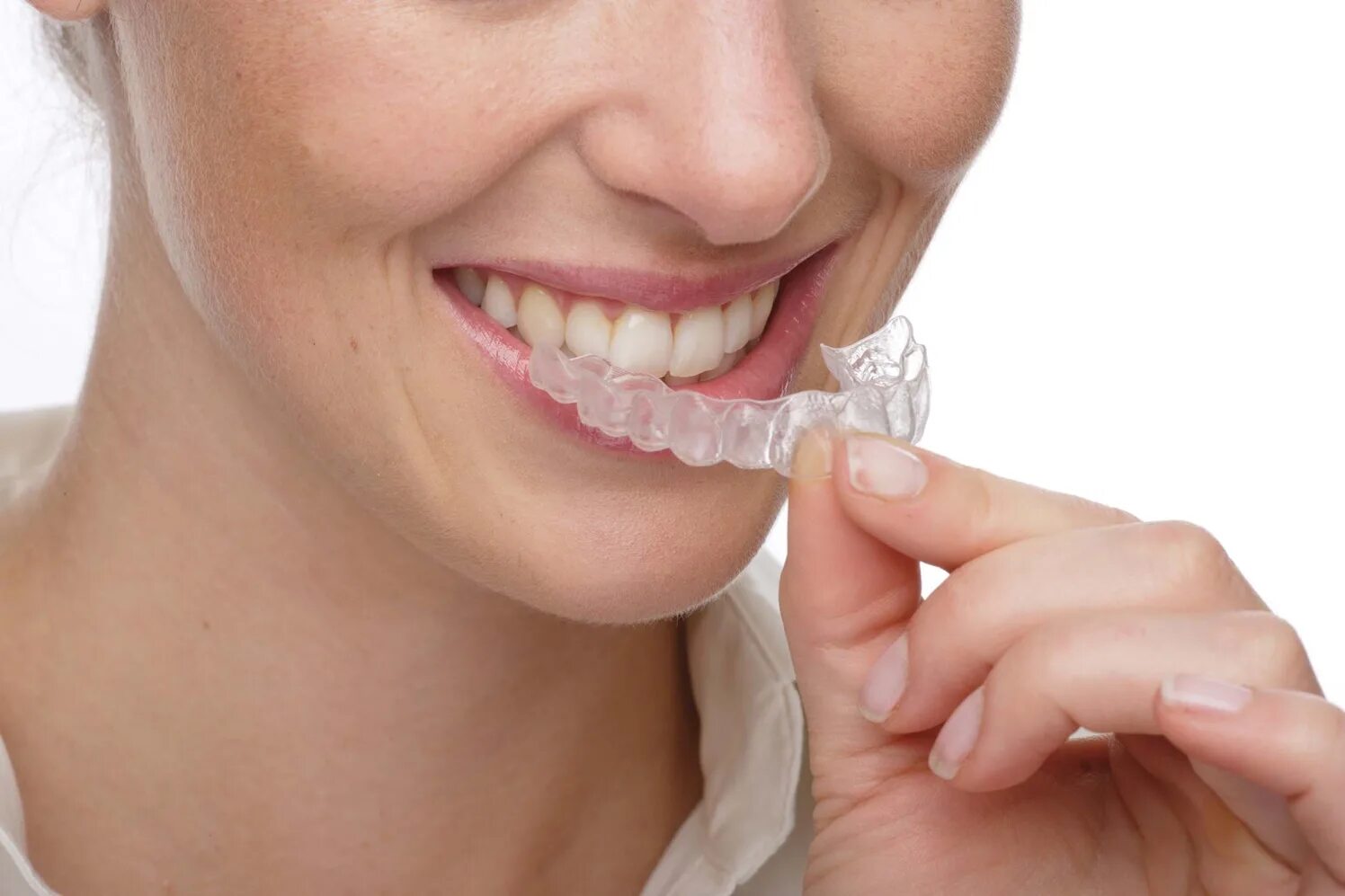 Invisalign. Каппы инвизилайн invisalign. элайнеры американские invisalign.
