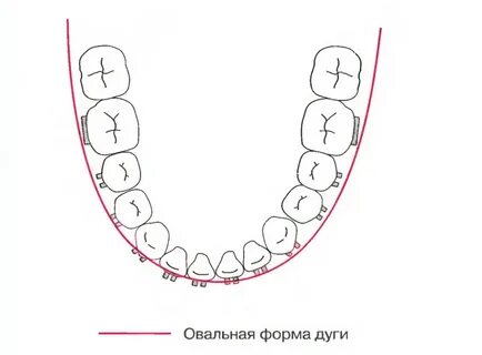 Зубные дуги верхней и нижней челюстей