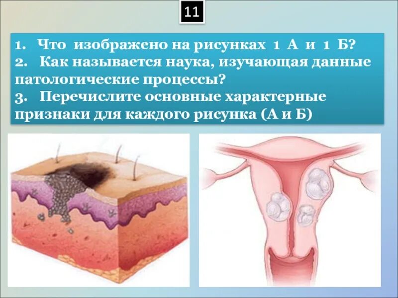 Назовите патологических процессов. Патологический процесс. Основные патологические процессы. Патологический процесс симптомы. Основы патологии картинка.