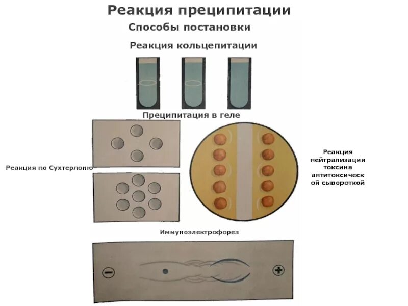 Реакция преципитации в геле компоненты. Реакция диффузионной преципитации (РДП).. Реакция преципитации по Оухтерлони. Реакция преципитации в геле (метод Оухтерлони). Диффузная реакция