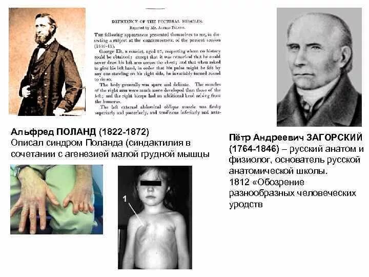 Анатомическая школа загорского. Анатомическая школа загорского. Анатомическая школа загорского. Анатомическая школа загорского. Загорский вклад в медицину.