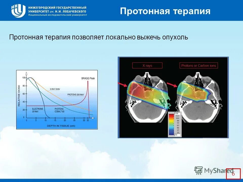 Протонная лучевая терапия. Протонная лучевая терапия презентация. Протонная терапия схема. Преимущества протонной терапии. Протонная терапия рака