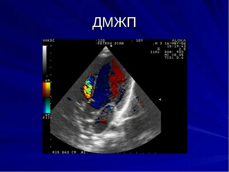 Эхо сердца в новокузнецке. Обследование сердца ребенка. Обследование сердца ребенка. Программа "медгородок с доктором хлыновым". Эхо сердца в новокузнецке.