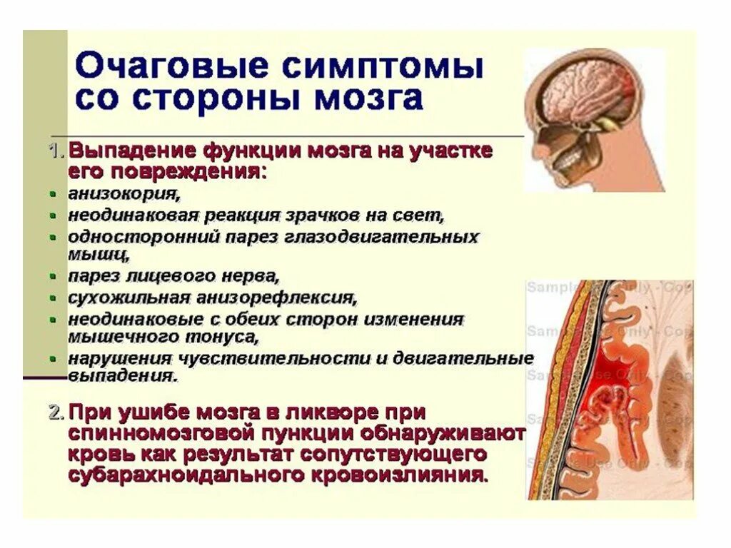 Температура при сотрясении. Очаговые симптомы. Сотрясение головного мозга очаговая симптоматика. Сотрясение ГМ симптомы. Очаговая симптоматика при травмах головы.