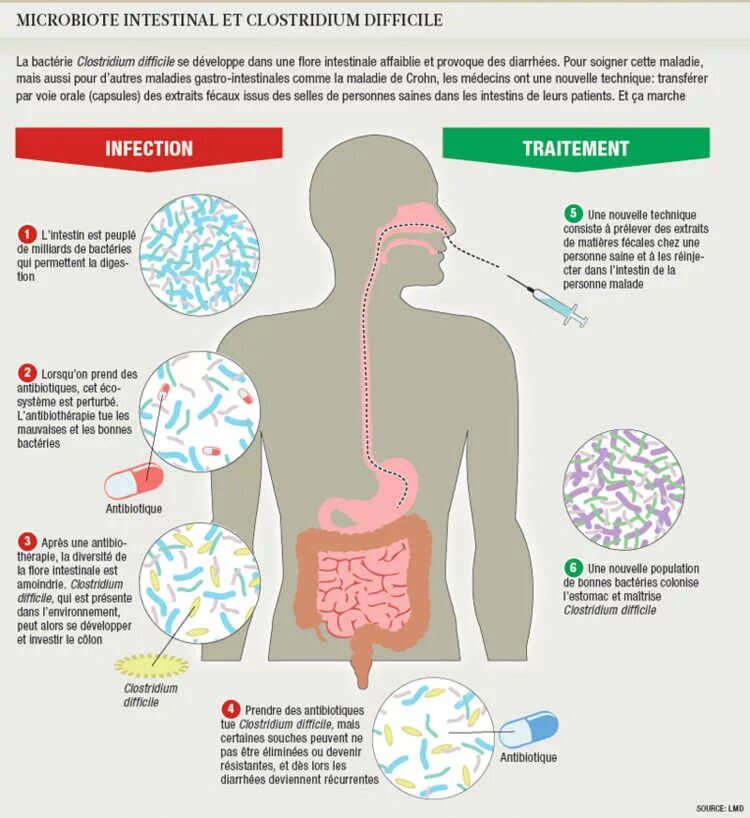 Est difficile. Токсины а и в Clostridium difficile. Clostridium difficile диагностика. Clostridium difficile путь заражения. Энтероколит вызванный Clostridium difficile.