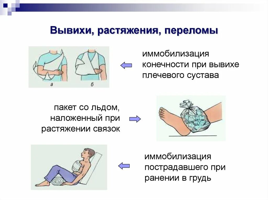 Ушиб, растяжение, перелом первая помощь. Растяжение и разрыв связок ПМП. Ушиб растяжение вывих ПМП. Ушибы, растяжения вывихи переломы оказание помощи.