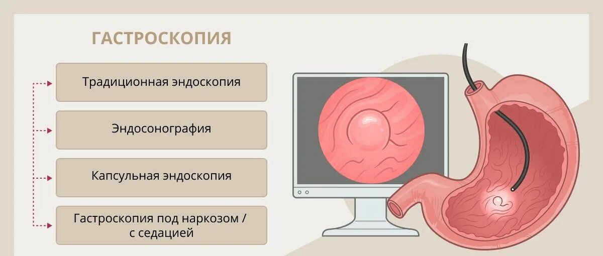 Эгдс и фгдс в чем разница что. Проведение гастроскопии желудка. Фиброгастродуоденоскопия (ФГДС).