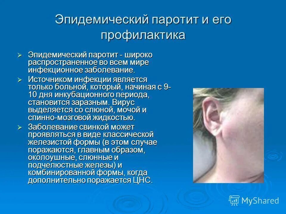 Эпидемический паротит Свинка симптомы. Симптомы болезни паротит. Свинка эпидемический паротит клиника. Заболевания Свинка инфекционные заболевания. Свинка признаки болезни у детей симптомы