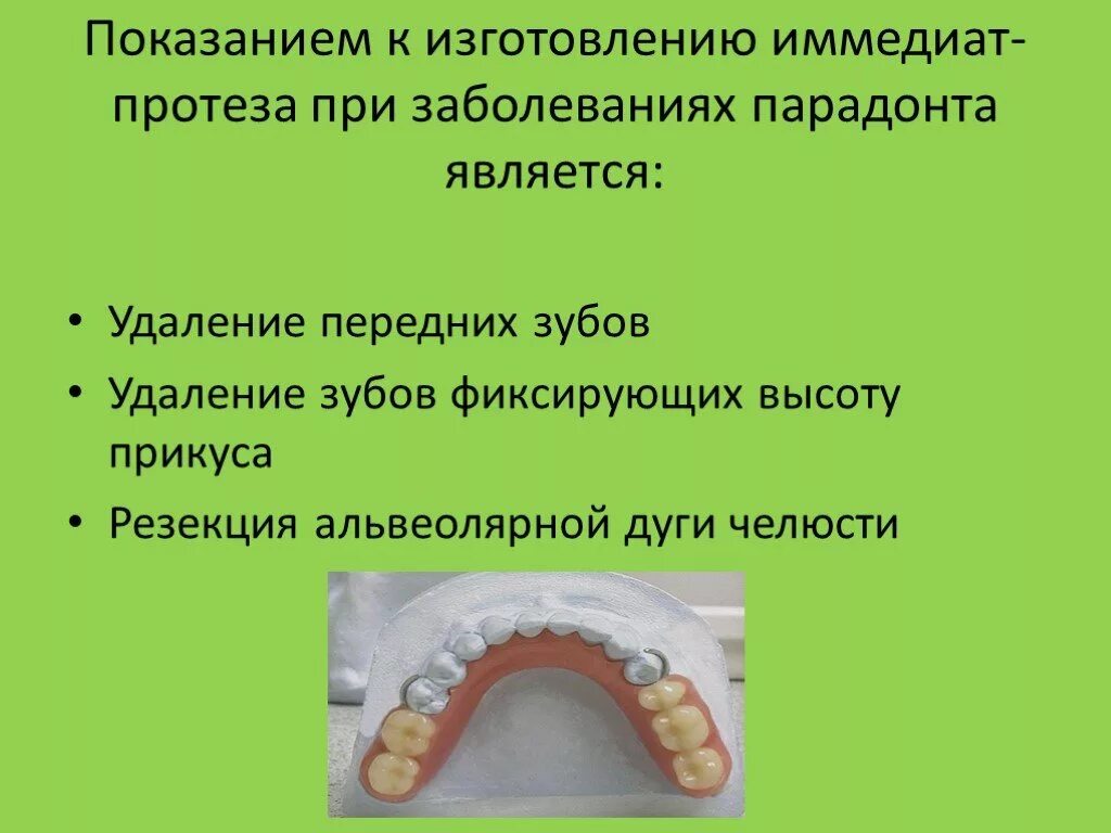 Изготовление иммедиат протеза. Методика наложения иммедиат протезов. Клинико лабораторный этап изготовления иммедиат. Этапы изготовления иммедиат протеза. Иммедиат протезы показания.