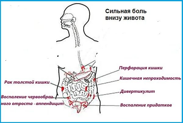 Что находится снизу живота. Болит низ живота. Болит внизу живота. Болит бок слева. Левая сторона внизу живота.