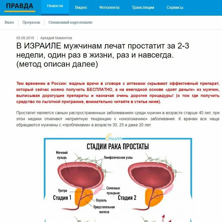 От чего бывает простатит. Реклама простаты. лечение простатита реклама.