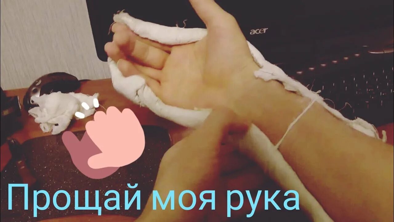 Рано снял гипс. Как снимать гипсы картинка.