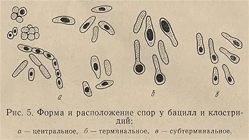 Клостридии споры расположение. Расположение спор у бактерий микробиология. Строение споры и ее расположение у бацилл рисунок. Расположение спор у бацилл. Форма спор бактерий