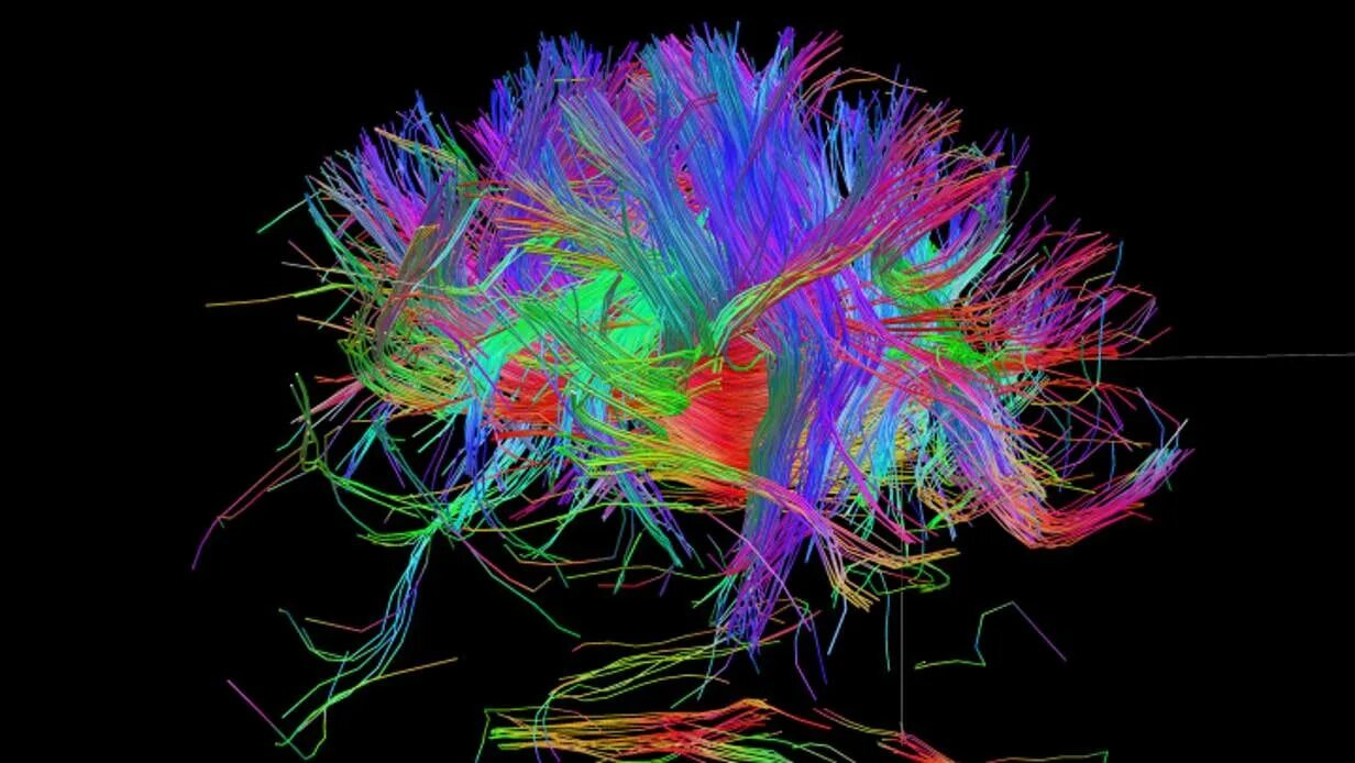 Нейросеть головного мозга. Разноцветный мозг. Коннектом мозга человека это. Нейронные связи в мозге.