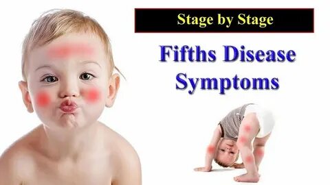 Children infectious diseases