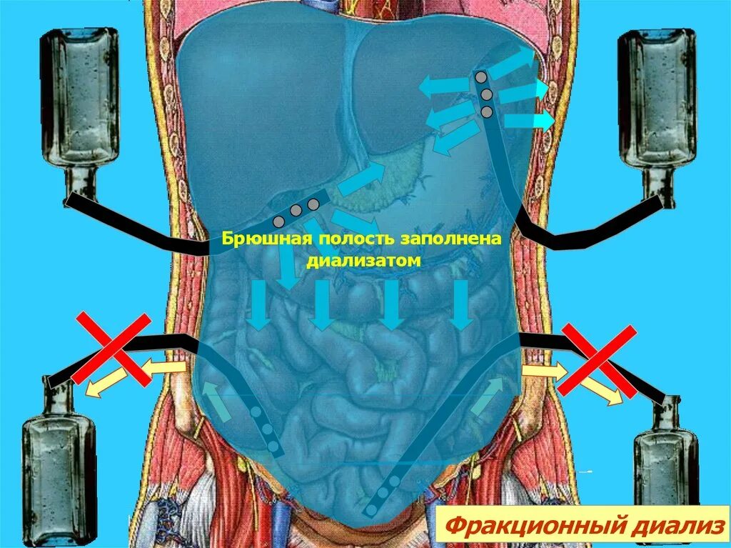 Как проверить брюшную полость
