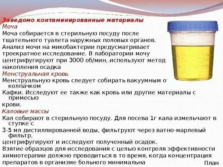 Сколько мочи нужно для общего анализа взрослого. Исследование мочи. Анализ мочи. Исследование мочи на стерильность. Сдача мочи.